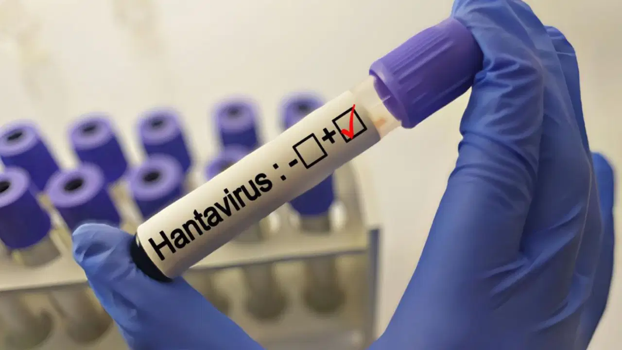 Grip ile karıştırılıyor: Uzmanlardan 'hantavirüs' açıklaması