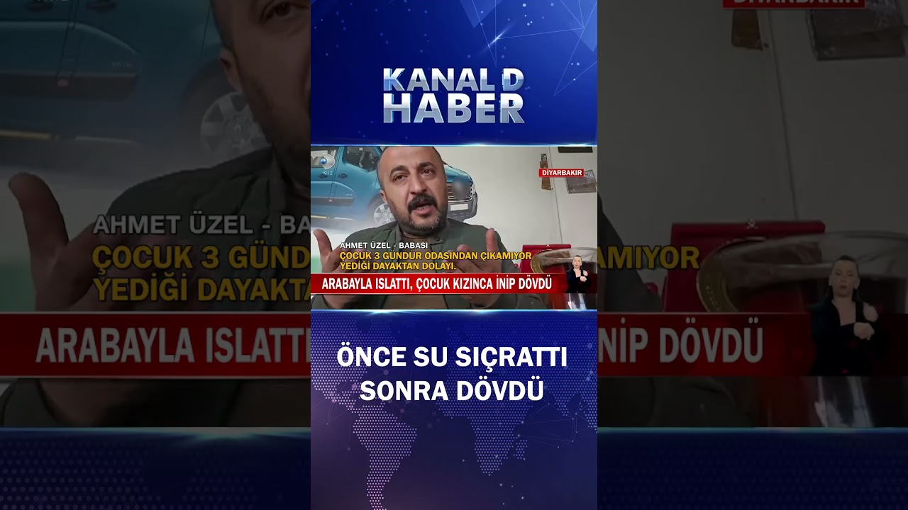 Arabayla Islattı, Çocuk Kızınca İnip Saldırdı