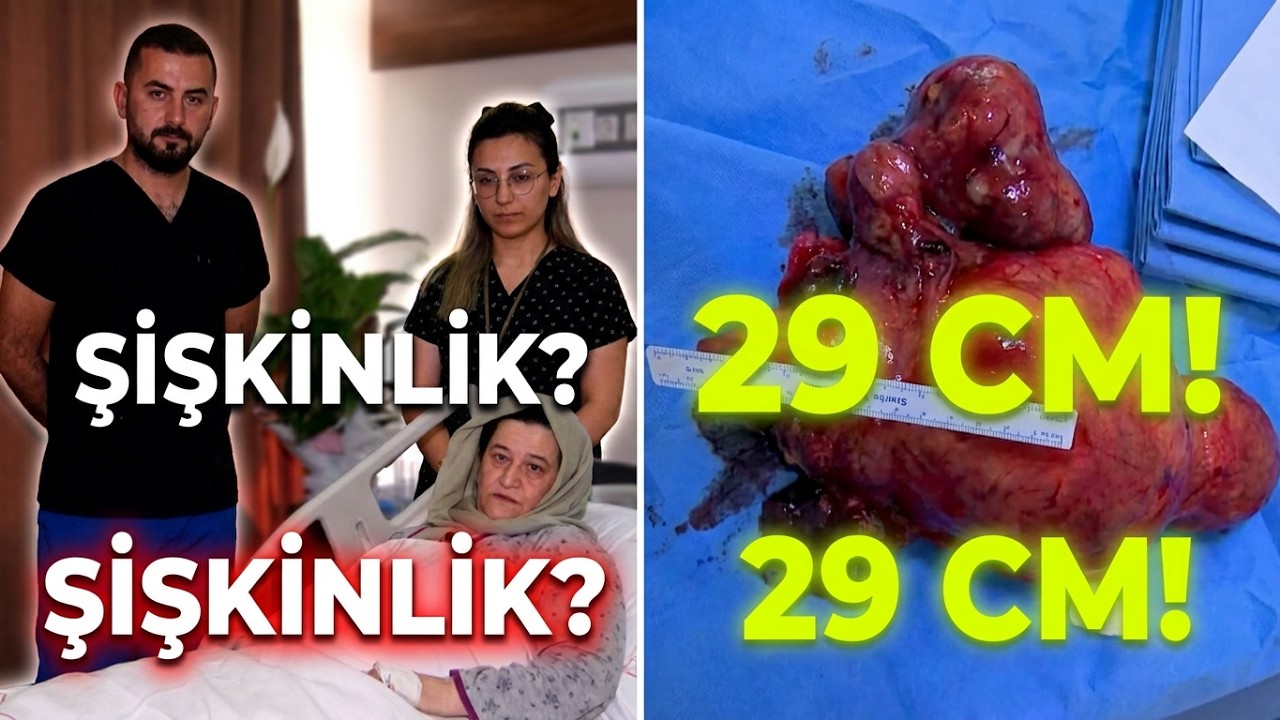 İnanamayacaksınız Şişkinlik Değilmiş!👀 Doktorlar Bile Şaşırdı
