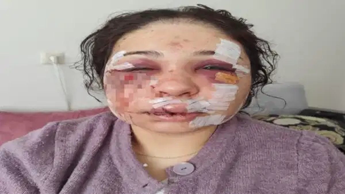 Boşanma aşamasındaki eşini öldüresiye darbeden polis memuruna tahliye: Haksız tahrik ve iyi hal indirimi uygulandı!