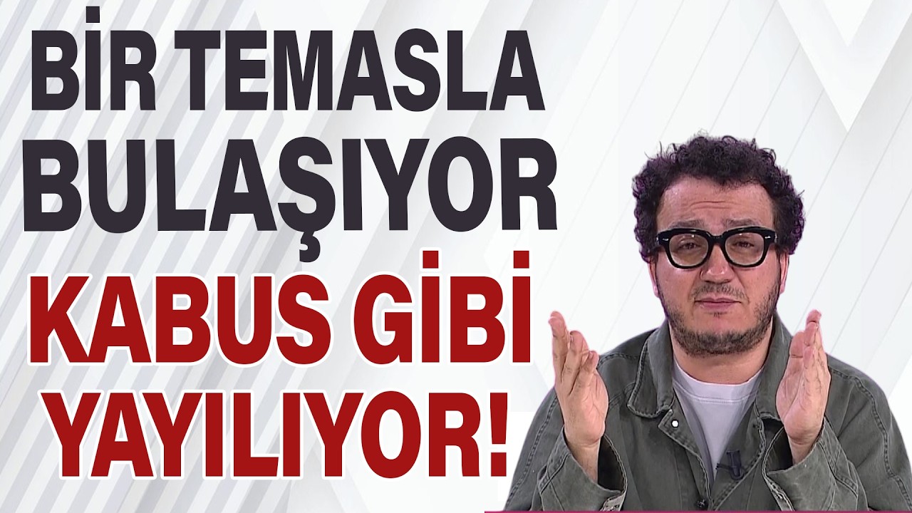Bir Temasla Bulaşıyor! Kabus Gibi Yayılıyor