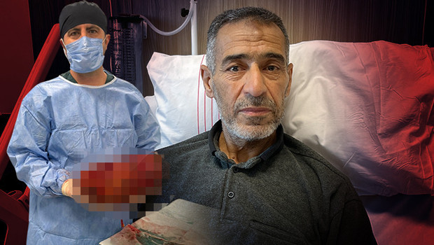 Ağrı şikayeti ile gitti, varılan teşhis doktorları da hayrete düşürdü | 'Normalde yarım kilo yoktur, benimki 8 kiloya ulaşmıştı'